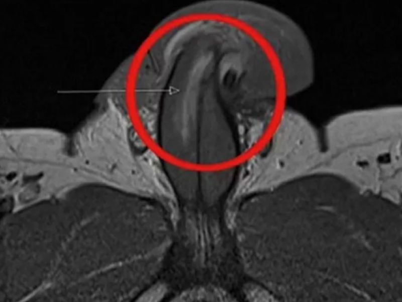 Reprodução / British Medical Journal Reprodução / British Medical Journal