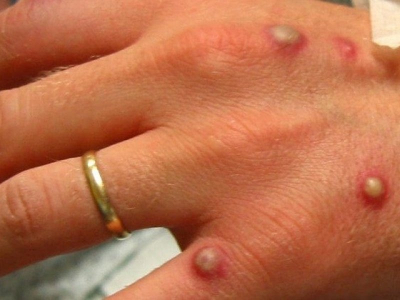 Reprodução/ Redes sociais Reprodução/ Redes sociais