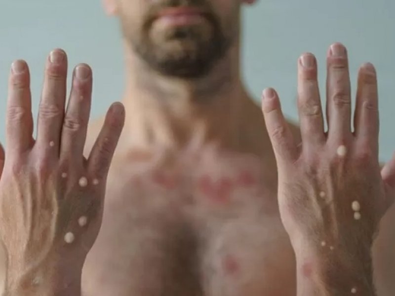 Divulgação Divulgação