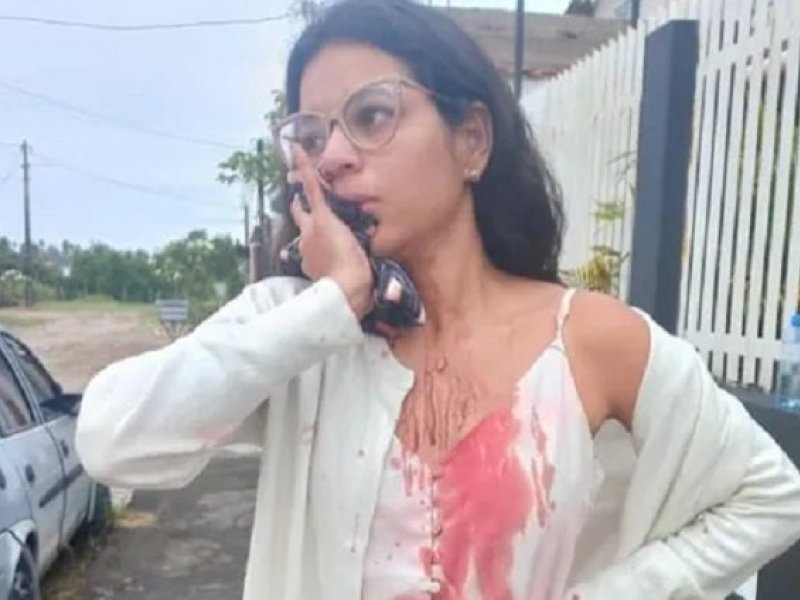 Reprodução Reprodução